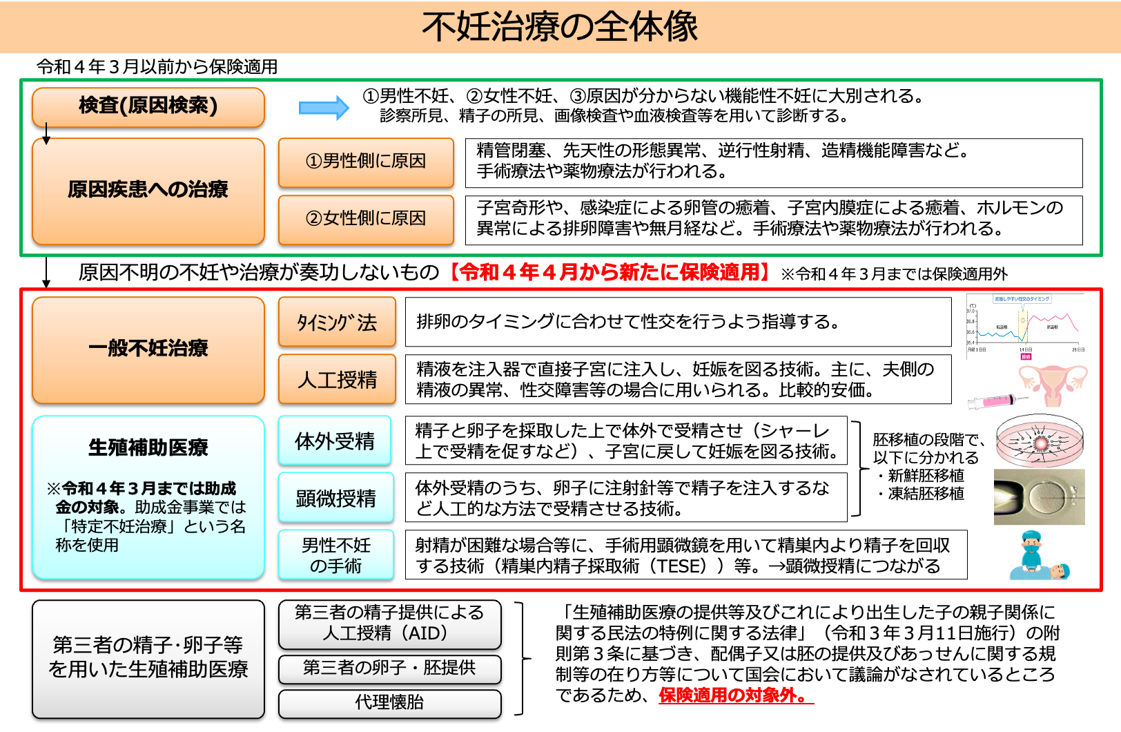 不妊治療の全体像